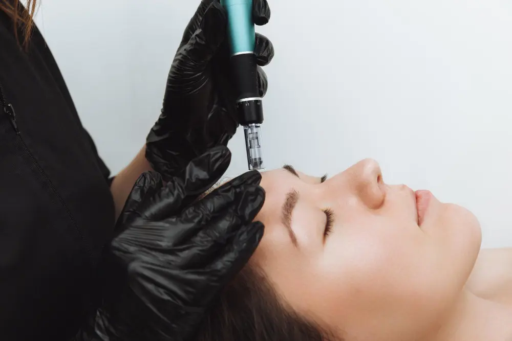 microneedling dubai