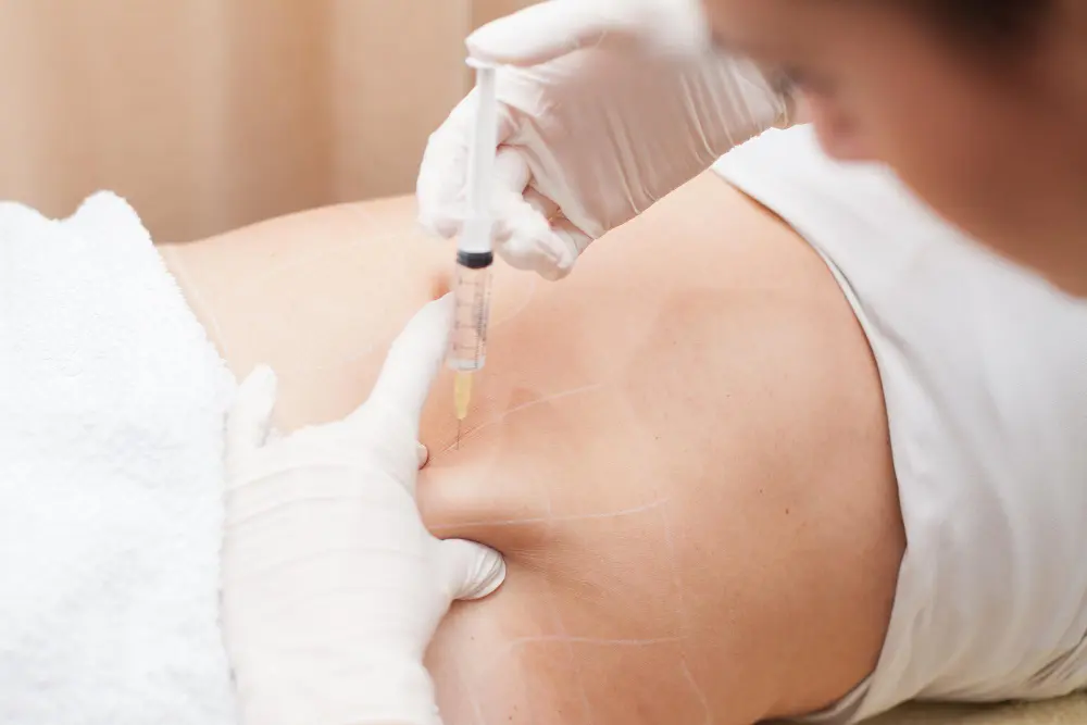 body contouring body fillers