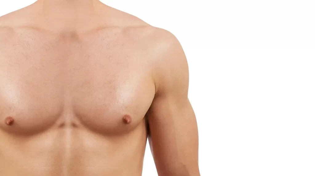 Gynecomastia surgery