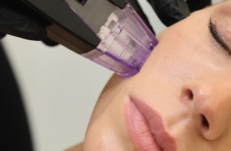 How Many Morpheus8 Sessions Are Needed for Results? - The Reformery Aesthetics Clinic