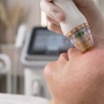 Why Your Skin Looks Tired — and Treatments That Restore Glow