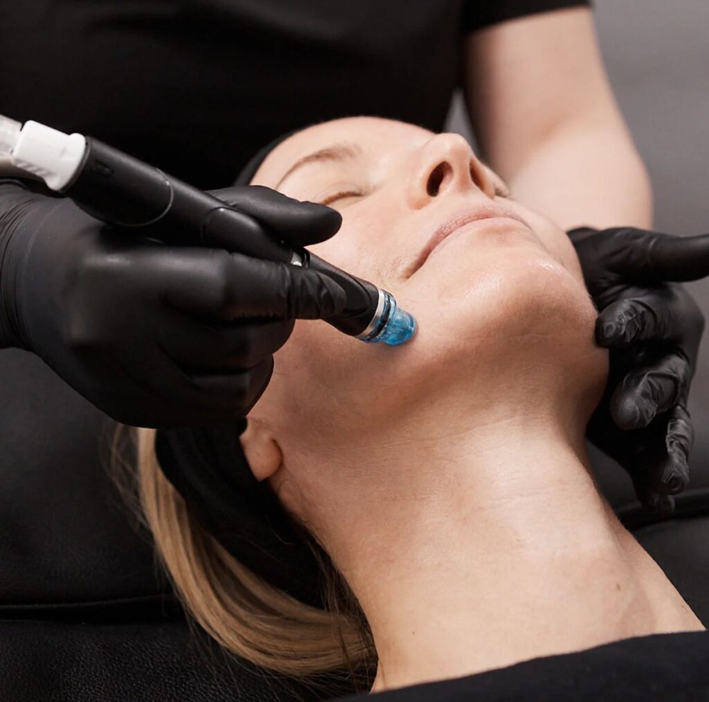 HydraFacial in Dubai - Reformery Aesthetics Clinic