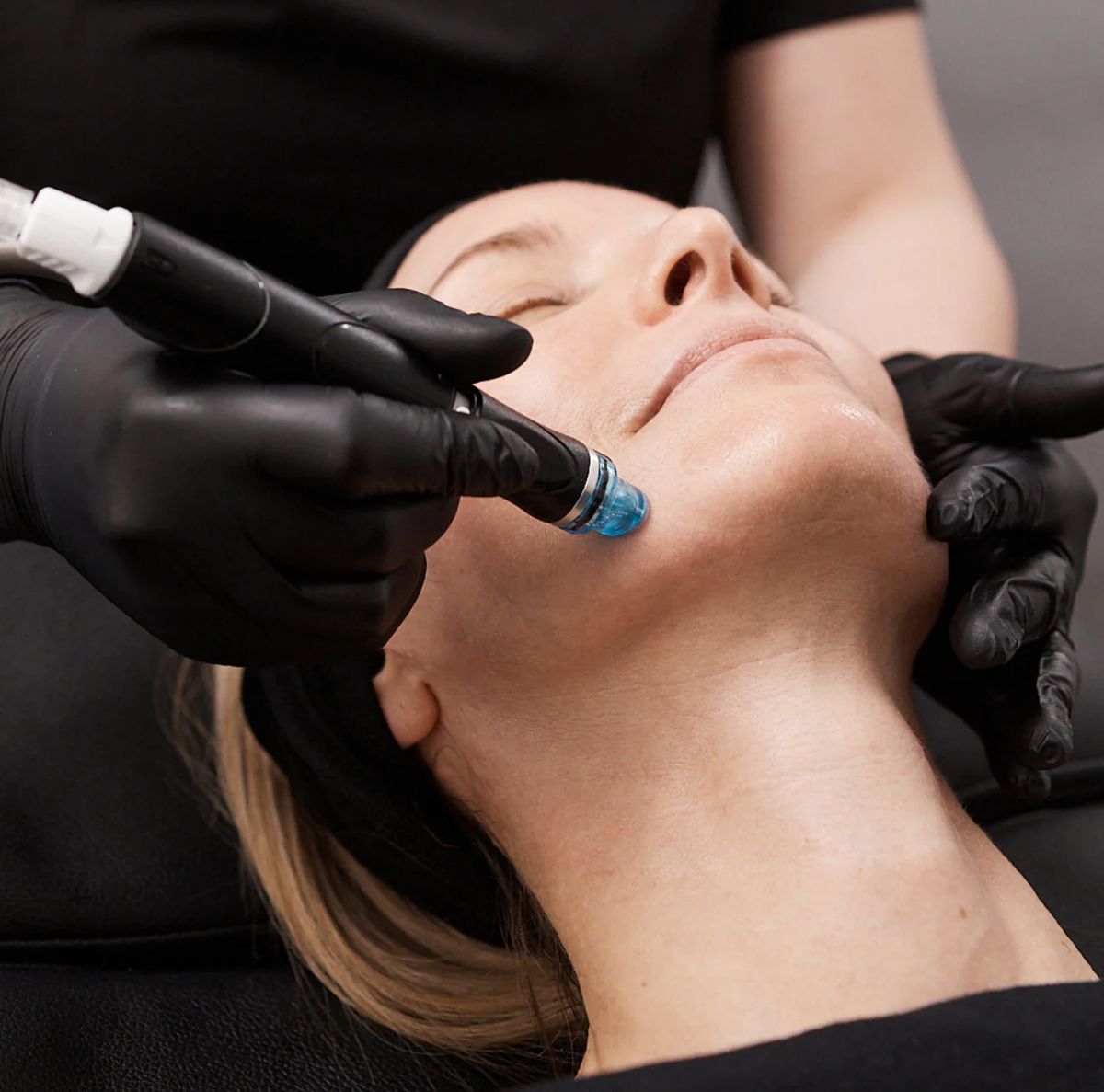 HydraFacial in Dubai - Reformery Aesthetics Clinic