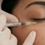Dark Circles Treatment: What Actually Works?