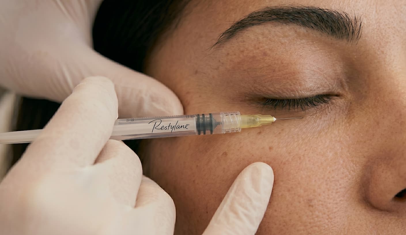 Dark circles treatment Dubai - The Reformery Aesthetics Clinic