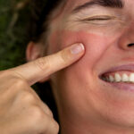 How to Treat Sun-Damaged Skin in Dubai’s Climate