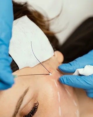 Thread lift combination treatments - Reformery Aesthetics Clinic