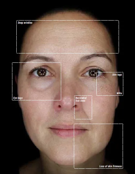 Alma IQ Skin Analysis