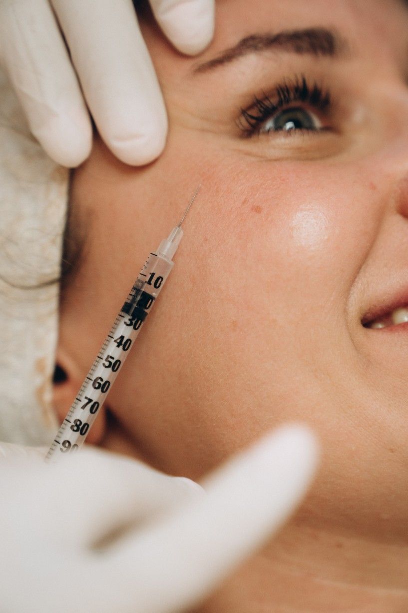 Lanluma skin tightening - Reformery Aesthetics Clinic