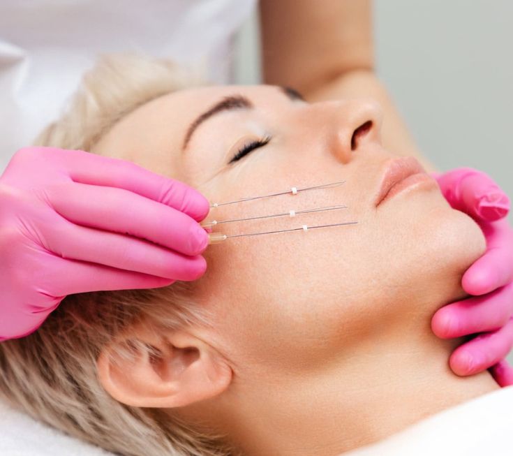 Thread Lift Treatment Dubai - Reformery Aesthetics Clinic