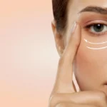 Under Eye Rejuvenation: The Best Treatments for Dark Circles and Hollow Eyes