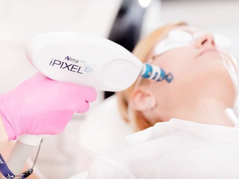 chemical peels vs laser resurfacing for a post-summer skin reset in Dubai