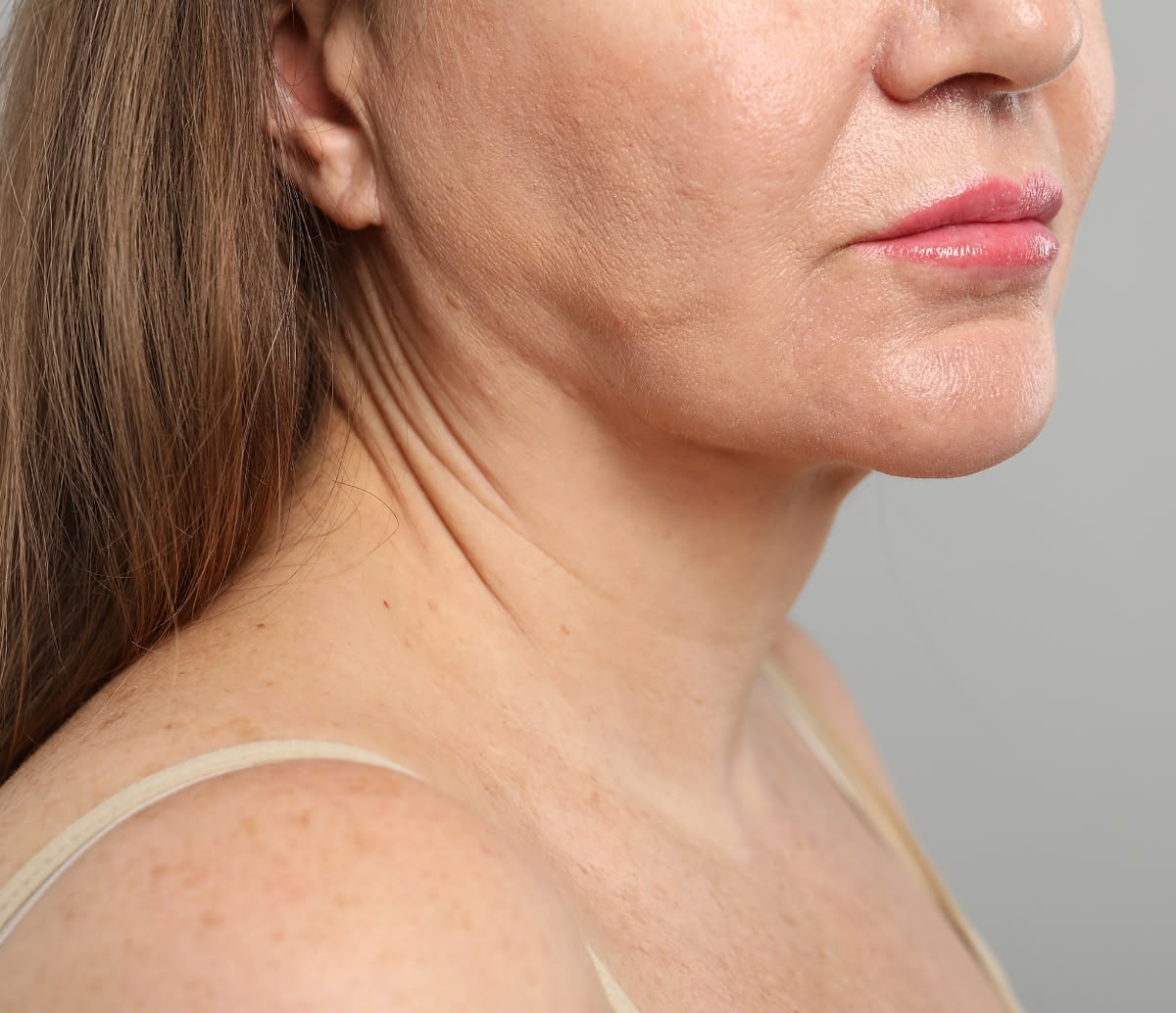 Mounjaro face treatment in Dubai