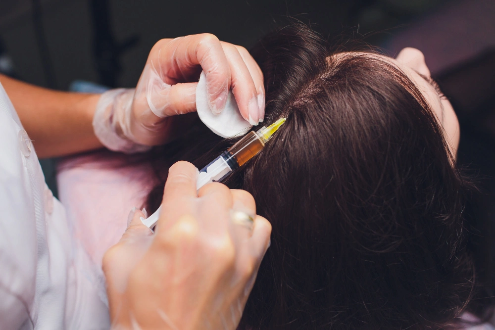 PRP vs Exosomes for Hair Loss: The Best Treatment in Dubai at The Reformery Aesthetics Clinic