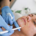 Sculptra and Collagen Biostimulators: A Natural-Looking Alternative to Filler?