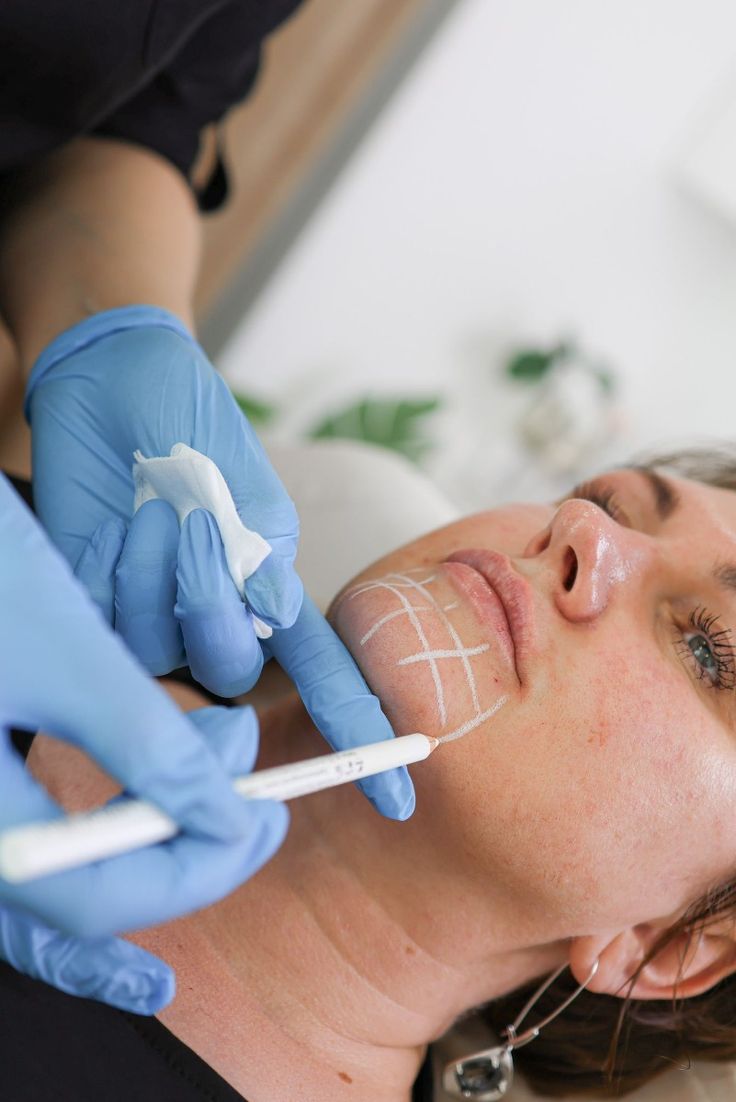 Woman with natural-looking skin representing Sculptra and collagen biostimulators in Dubai