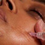 Skin Boosters vs Profhilo: Which Is Better for Hydration and Glow?
