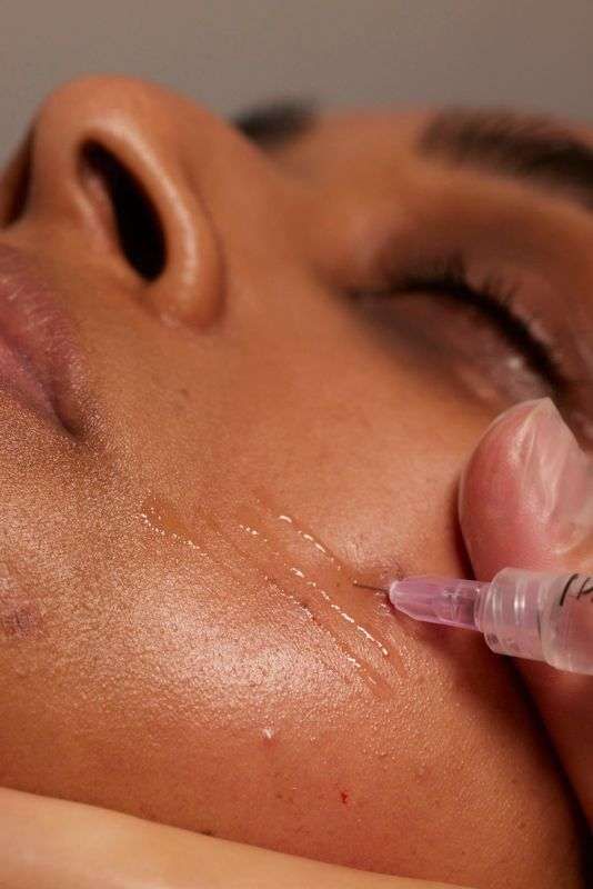 Skin boosters vs Profhilo for hydrated, glowing skin in Dubai