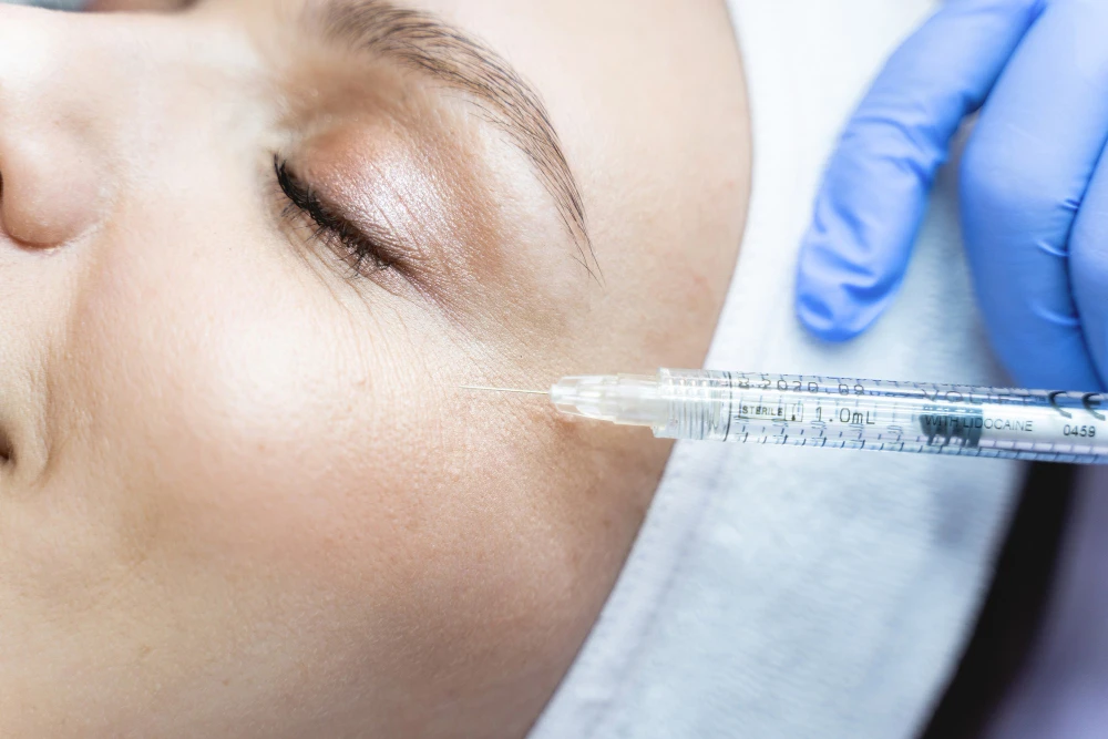 under-eye polynucleotides vs tear trough filler
