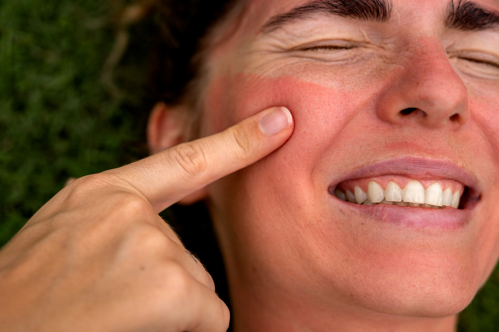 damaged skin barrier after summer