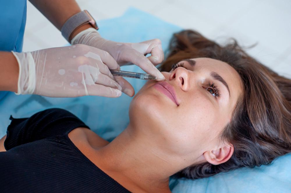 filler migration - Reformery Aesthetics Clinic