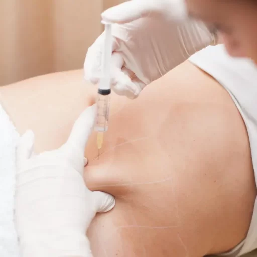 body contouring body fillers body contouring body fillers
