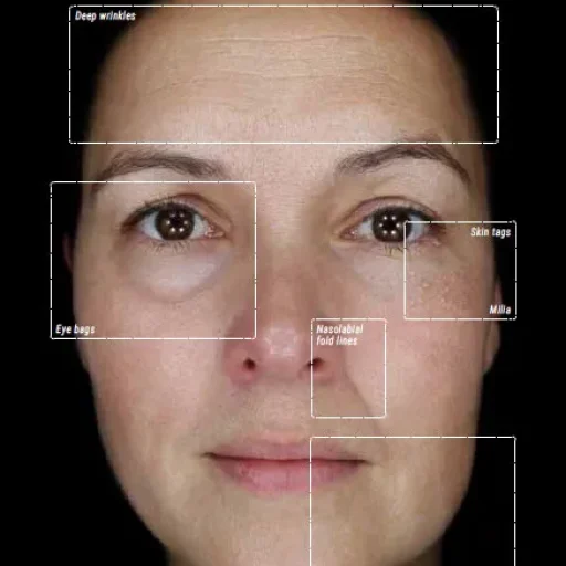 Alma IQ Skin Analysis