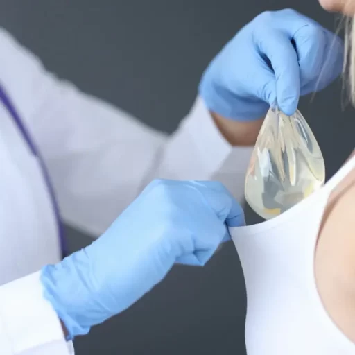 Breast Implants Breast Implants