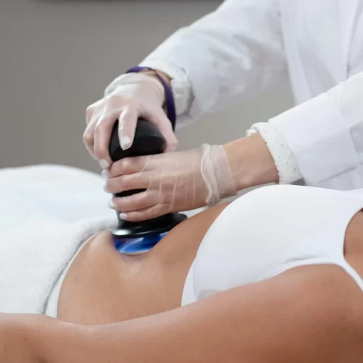 rf treatment alma primeX rf treatment alma primeX